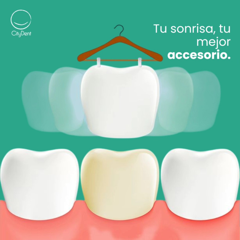 En CityDent, creemos que una sonrisa perfecta no solo mejora tu apariencia, sino que también aumenta tu confianza y bienestar.