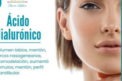 Ácido Hialurónico