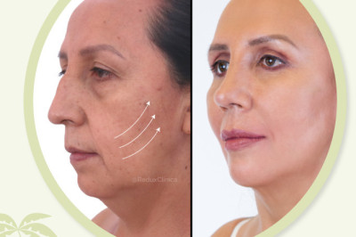 Paquete Facial con 25% de descuento