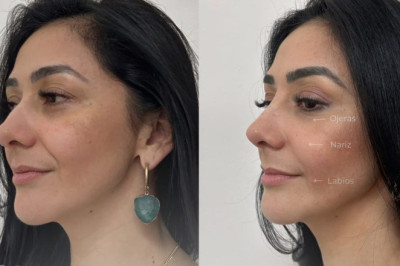 Rejuvenecimiento 25% OFF