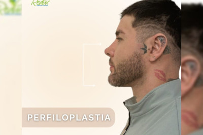 ¡PERFILOPLASTIA !