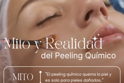 Peeling químico: mito vs. realidad