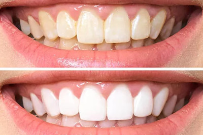 🦷 La ortodoncia, clave para una sonrisa sana y funcional