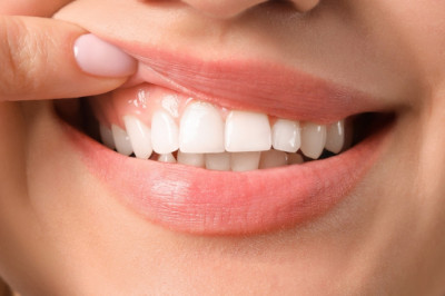 🦷 Tu sonrisa también se cuida desde la mesa – Dentes